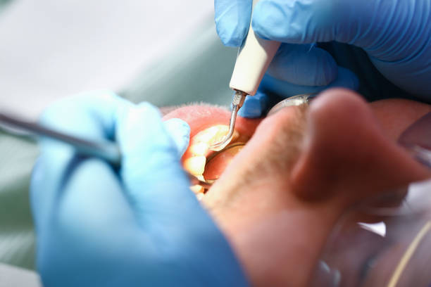 Best Emergency Treatment for Jaw Pain or Injury in Siena College, NY